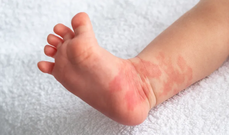 Speciality Description Image