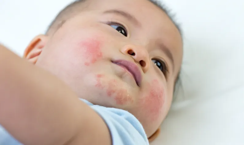 Speciality Description Image